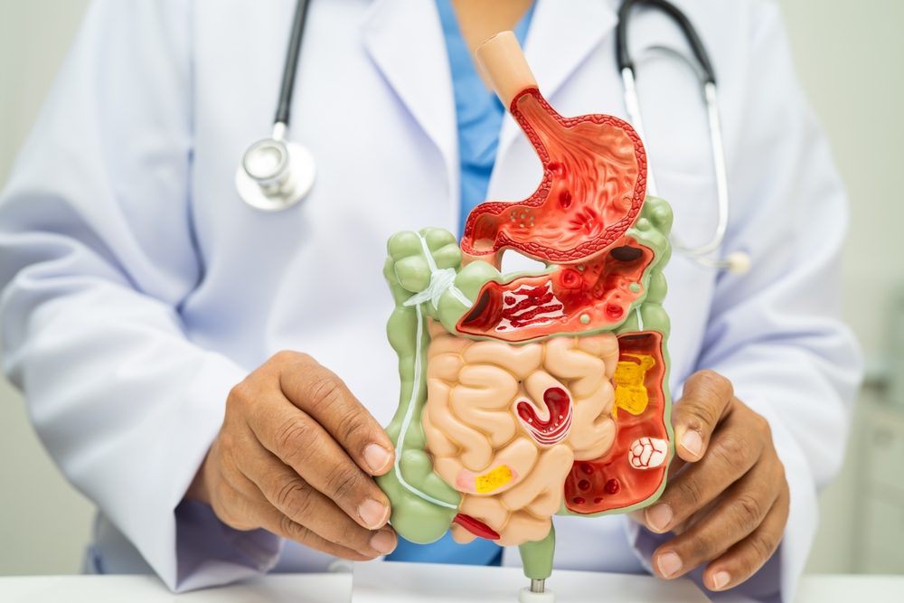 Retos frecuentes de viajar para cirugía gastrointestinal