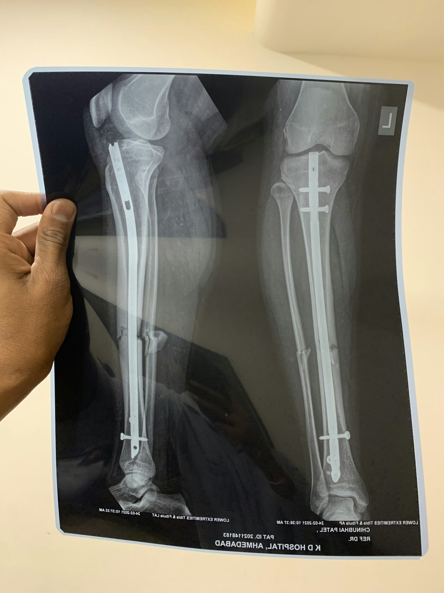 Ortopedia y traumatología